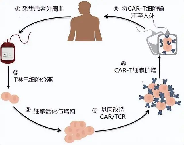 CAR-T细胞治疗的抗癌药一种靠谱的创新疗法